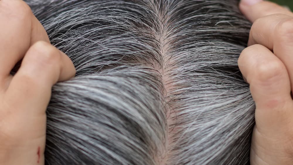 Yao Secret How to Prevent Grey Hair? Tips to Reverse Grey Hair